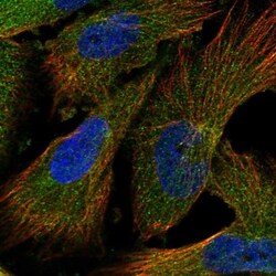 INPP5B Antibody, Novus Biologicals:Antibodies:Primary Antibodies